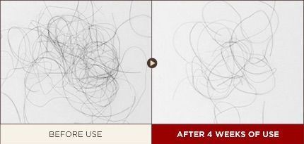 The History of Whoo Whoospa Scalp Anti-Aging & Hair Lifting Shampoo Set
