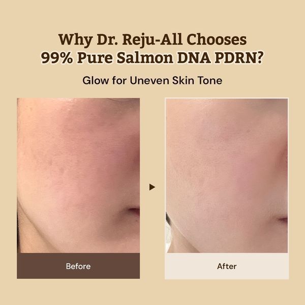 REJUALL Advanced PDRN Repair Крем з полінуклеотидами RA-PDRN-RC-20 фото